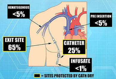 Sites protected by cath dry